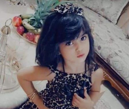 وفاة طفلة من العيزرية جراء حريق في منزل